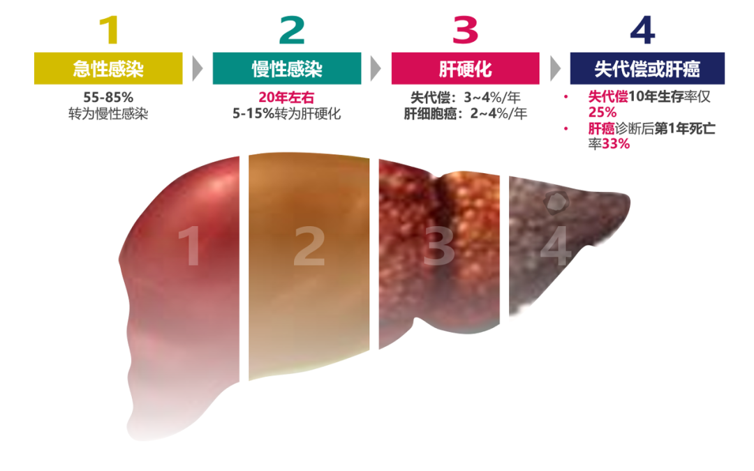 悄悄變成肝硬化、肝癌，很多人感染了卻不知道
